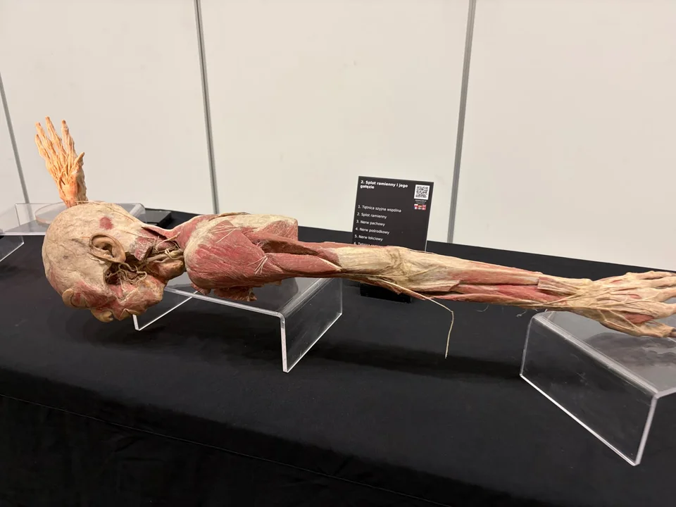 Prawdziwe ludzkie ciała w Hali Expo w Łodzi