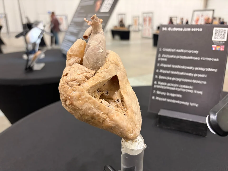 Prawdziwe ludzkie ciała w Hali Expo w Łodzi